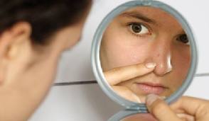 Como quitar el acne eficazmente